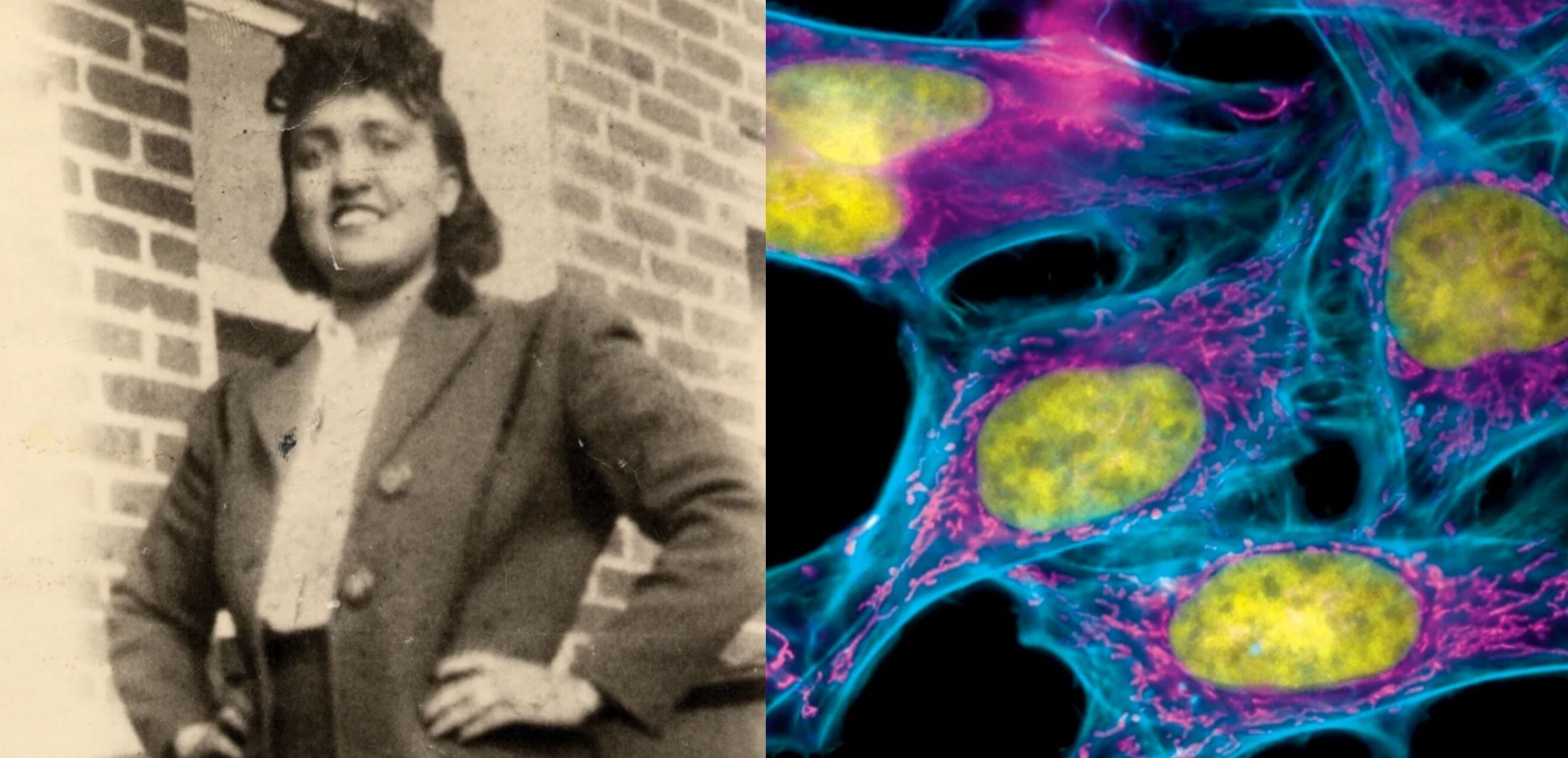 1940년대 후반에 찍은 헨리에타 랙스(왼쪽). 오른쪽은 헨리에타 랙스에게서 채취해 지금도 의학용으로 활용되는 헬라세포. 세포의 특정부분을 자세히 관찰하기 위해 특수 염색 처리했다./헨리에타 랙스 재단