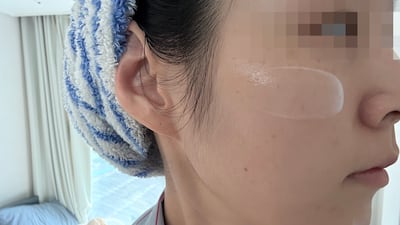 주름 수 347개→54개 임상, 서울대 보톡스 세럼을 기자가 직접 바른 후 느낀 변화
