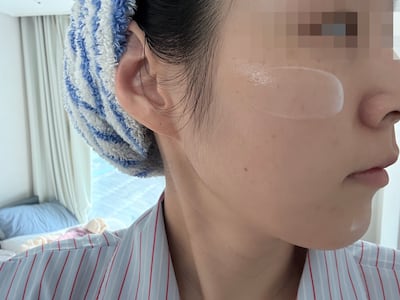 주름 수 347개→54개 임상, 서울대 보톡스 세럼을 기자가 직접 바른 후 느낀 변화