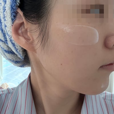 주름 수 347개→54개 임상, 서울대 보톡스 세럼을 기자가 직접 바른 후 느낀 변화