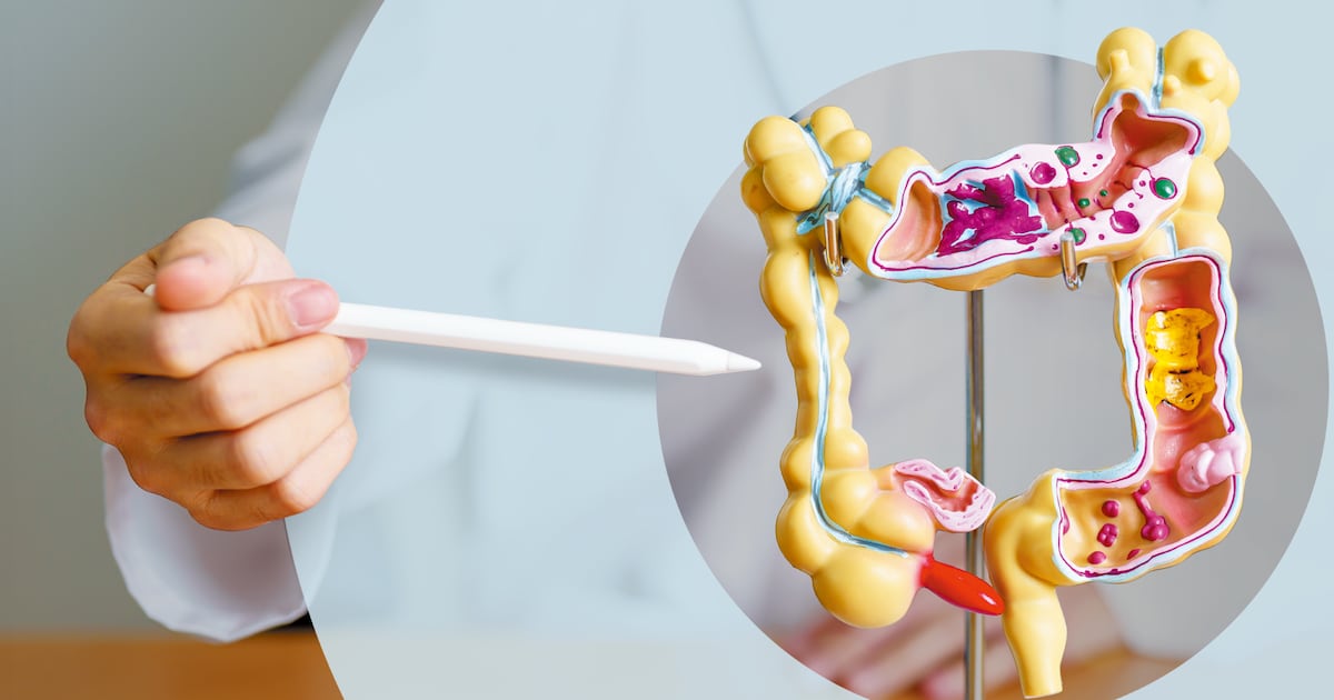 70세 넘어 대장내시경? 이제는 '노쇠' 관리가 먼저야