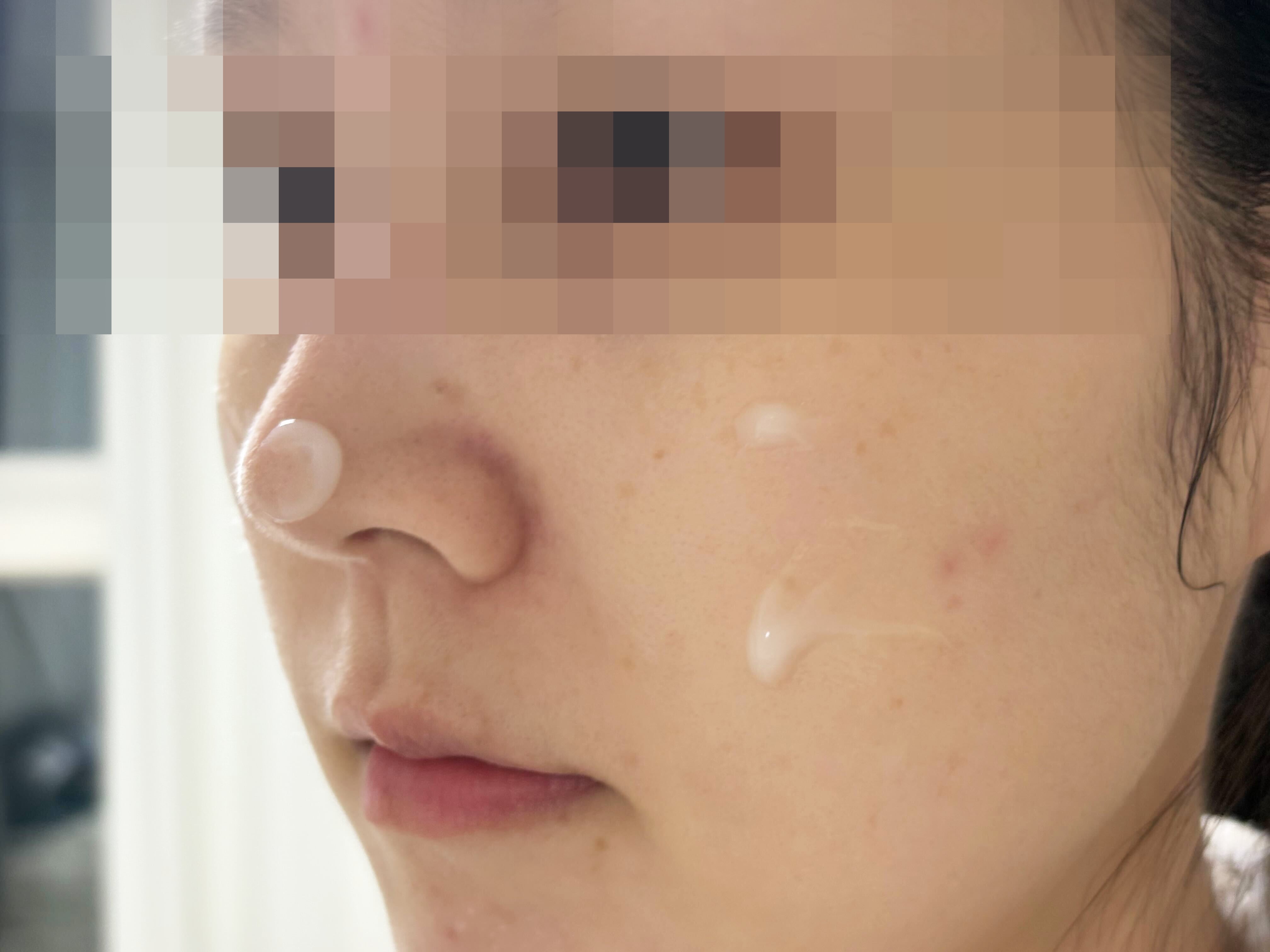 부부가 함께 쓰는 ‘경희대 보약 크림’, 매일 자기 전 바른 후 얼굴 주름에 온 변화