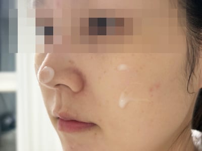 부부가 함께 쓰는 ‘경희대 보약 크림’, 매일 자기 전 바른 후 얼굴 주름에 온 변화