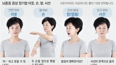 뇌졸중 증상 암기법 ‘이웃·손·발·시선’