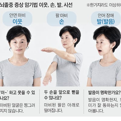 뇌졸중 증상 암기법 ‘이웃·손·발·시선’