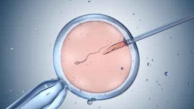AI로 ‘숨겨진 정자’ 찾았다... 무정자증 부부도 임신 성공