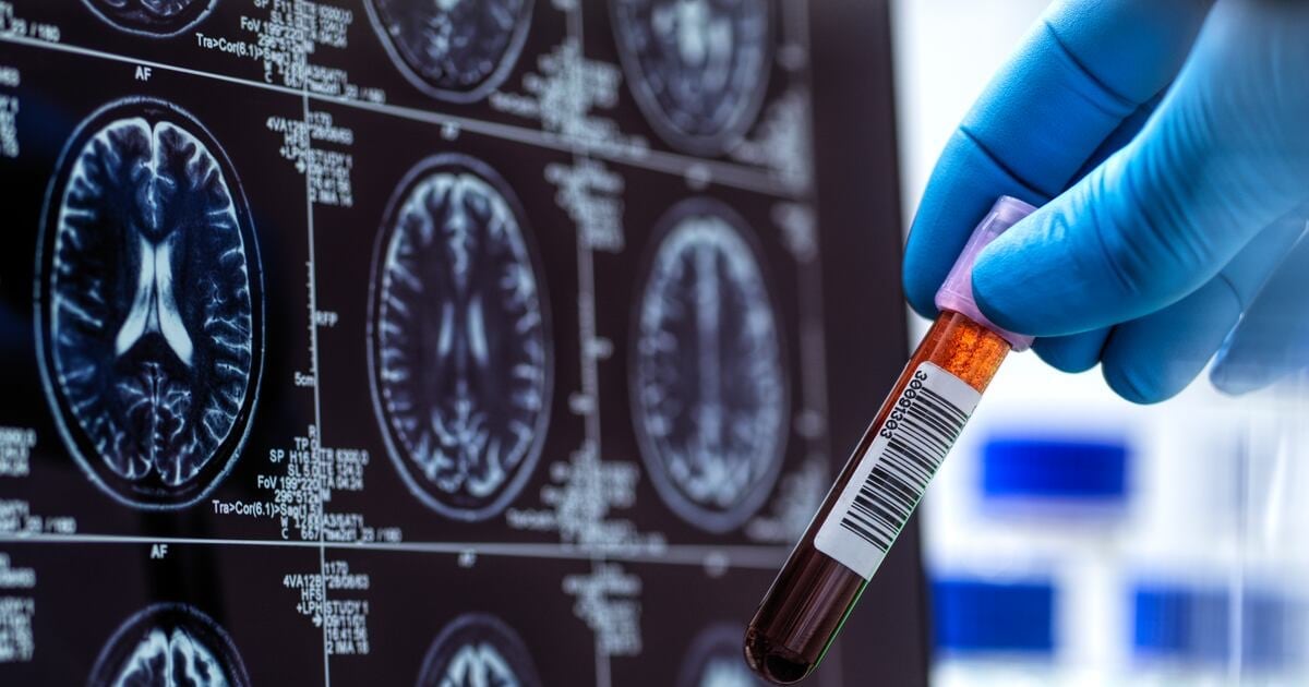 Eli Test FDA Approves Roche and Eli Lilly's Alzheimer's Blood Test