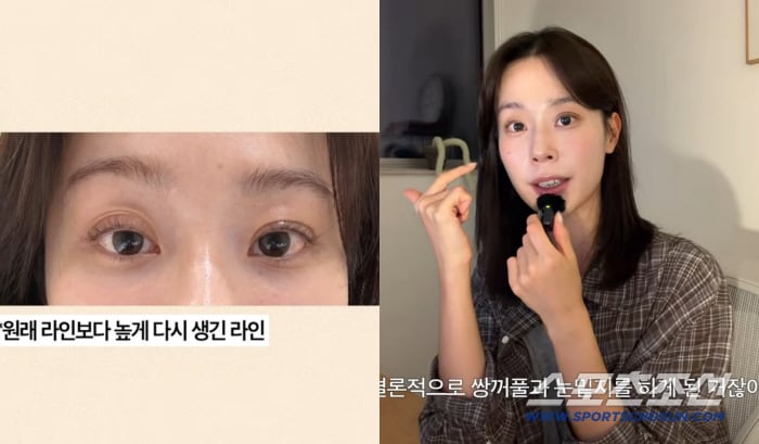 '하트시그널4' 이주미, 쌍꺼풀·눈밑지 성형 고백 "'눈 달라졌다'는 질문 많이 받아"