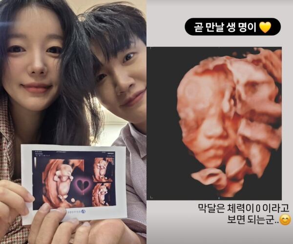 문지인, 아들 입체초음파 사진 공개…♥김기리와 똑같이 생긴 코에 ‘깜짝’