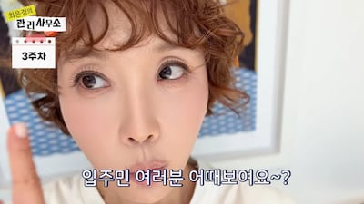최은경, '눈밑지' 시술 고백.."물체가 두 개로 보여 힘들었다" ('관리사무소')