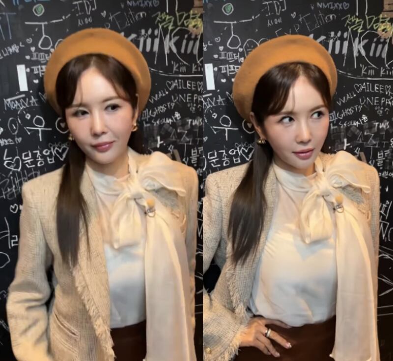 장영란, 무표정 얼굴에 해명 “화난 거 아님..서클렌즈 빼서 흰 자가 많이 보인 것”