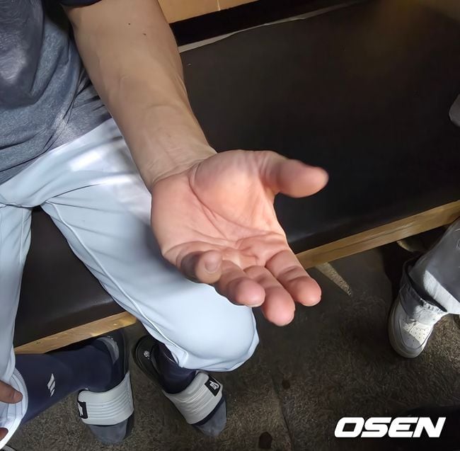 대충격! “평생 손가락 안 펴진다” 야구와 인생을 바꾸다니…정수빈 수술 거부 사태, 두산밖에 모르는 바보를 어찌할꼬