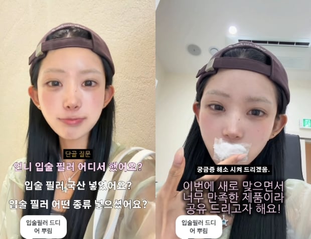 최준희, 입술 필러 또 맞았다..故최진실과 판박이 미모 “18살부터 해”