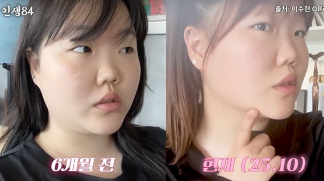 무려 '30kg' 감량…악뮤 수현, 칩거생활 끝낸 이유 "오빠랑 절연할까 봐"