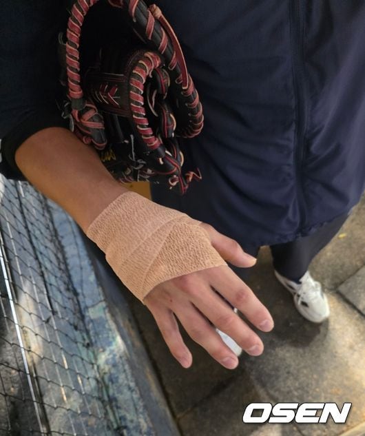 두산 날벼락! 병원 이동→붕대 감은 손과 함께 복귀라니, 예상보다 상처 깊었다 “4바늘 꿰맸어요, 내일 경기는…”