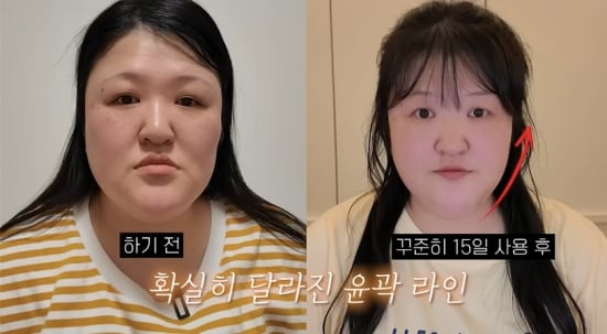이국주, 쳐진 턱선 관리하더니..애프터 사진 당당 공개 “나이 드니 민낯 부끄러워”(이국주)