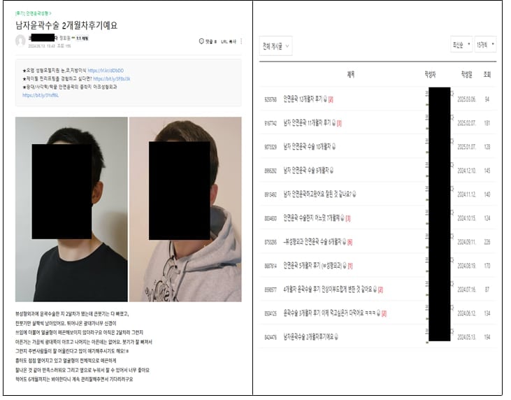 수술비 할인해 줬으면서 ‘내돈내산’처럼 후기 올리게 한 강남 성형외과 3곳 적발돼