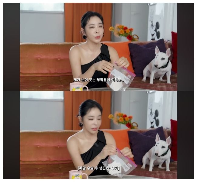 이혜영, 폐암 수술 후유증 밝혀 "눈 자주 부어 쌍꺼풀 사라져"('혜영이는 못말려')