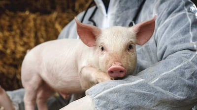 돼지 간·신장, 첫 동시 이식… 기증 장기 부족 문제 풀릴까