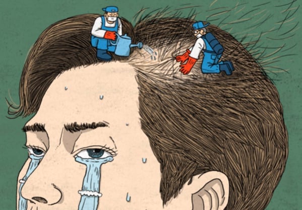 탈모 일러스트. /조선DB