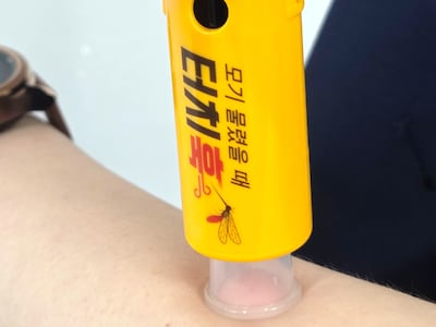 물파스 버렸다, 가려움 없애 매년 5만개 팔리는 모기 침 흡인기