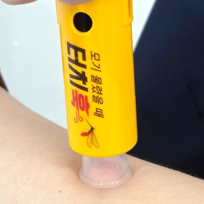 물파스 버렸다, 가려움 없애 매년 5만개 팔리는 모기 침 흡인기