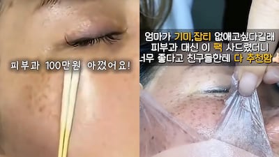바르자마자 기미 사라지고, 이가 하얘진다고?… ‘기막힌’ 광고가 판친다