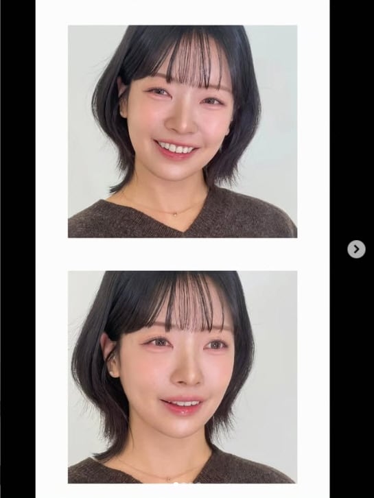 '뒷담화 논란' 31기 영숙, 확 달라진 얼굴…"광고 아닙니다"