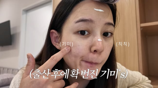 “출산 후 기미 생겨” 남보라, ‘출산 5일째’ 망가진 몸 상태 전했다 (인생극장)