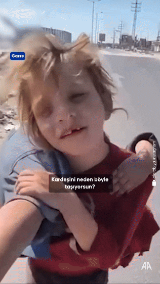 다리를 다친 여동생을 업고 의료진에게 가기 위해 길을 걷고 있는 소녀. /안나돌루 통신 인스타그램