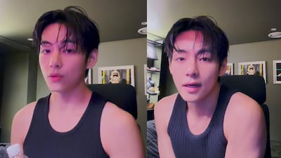 BTS 뷔 “이갈고 나왔으니 많이 예뻐해주세요”