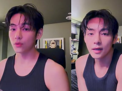 BTS 뷔 “이갈고 나왔으니 많이 예뻐해주세요”