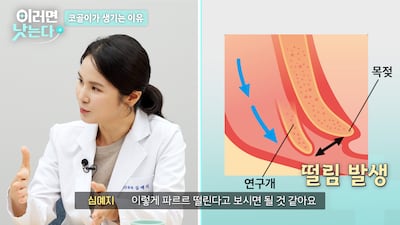 매일밤 코 고는 당신! 단순 잠버릇이 아닙니다