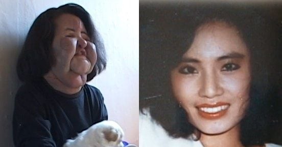 불법 성형 관련 이슈를 다룬 기사 이미지