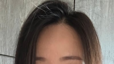 “와, 볼륨이다” 화제의 카이스트 탈모 샴푸, 기자가 1년 쓰고 느낀 변화