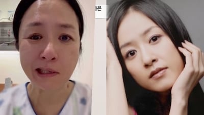 배우 지종은, 돌연 사라진 이유 “원인 모를 안면마비..입까지 돌아가” (‘특종세상’)