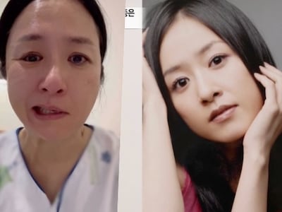 배우 지종은, 돌연 사라진 이유 “원인 모를 안면마비..입까지 돌아가” (‘특종세상’)