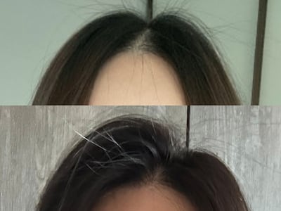 슉슉 뿌리고 말리니 진짜로 풍성해 보인다, 카이스트 탈모 스프레이