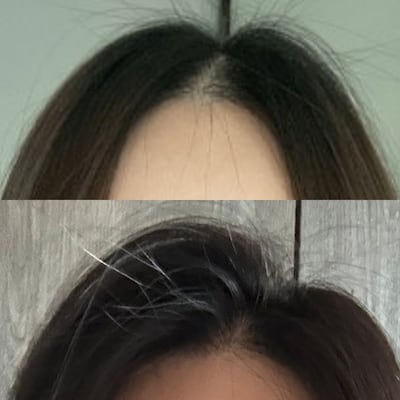 슉슉 뿌리고 말리니 진짜로 풍성해 보인다, 카이스트 탈모 스프레이