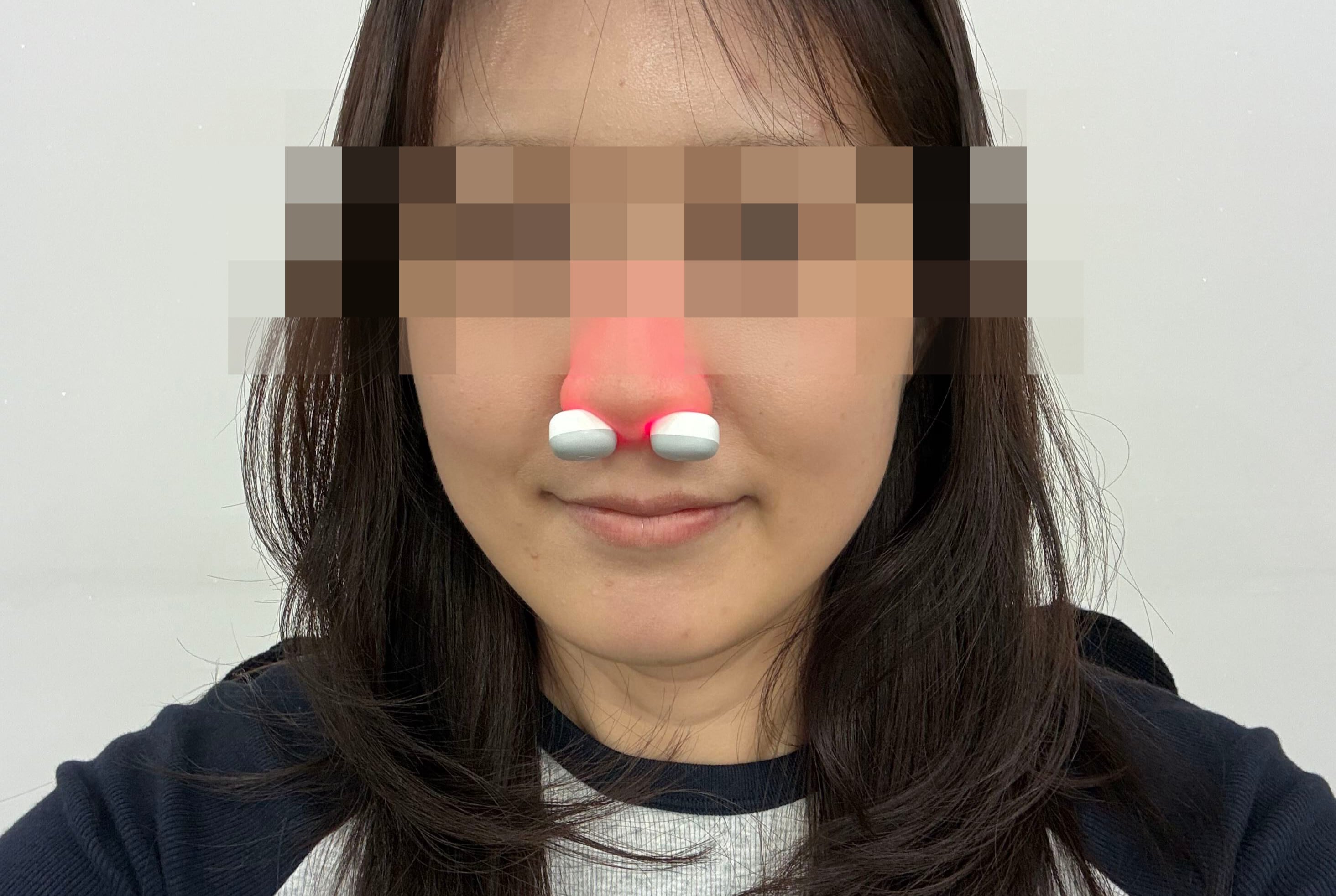 코 푸는 소리로 출근 신고하던 기자, 코에 툭 넣는 치료기 쓴 후 얻은 변화