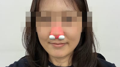 코 푸는 소리로 출근 신고하던 기자, 코에 툭 넣는 치료기 쓴 후 얻은 변화