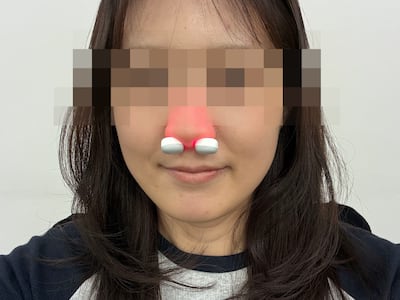 코 푸는 소리로 출근 신고하던 기자, 코에 툭 넣는 비염 치료기 쓴 후 얻은 변화