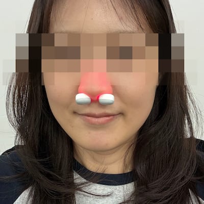 코 푸는 소리로 출근 신고하던 기자, 코에 툭 넣는 비염 치료기 쓴 후 얻은 변화