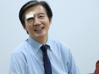 “작은 사고” 눈에 멍든 조국, 실핏줄 터진 김용남